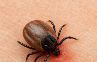 Kırım Kongo Kanamalı Ateşi (KKKA) ve Diğer Önemli Kene Kaynaklı Hastalıklar